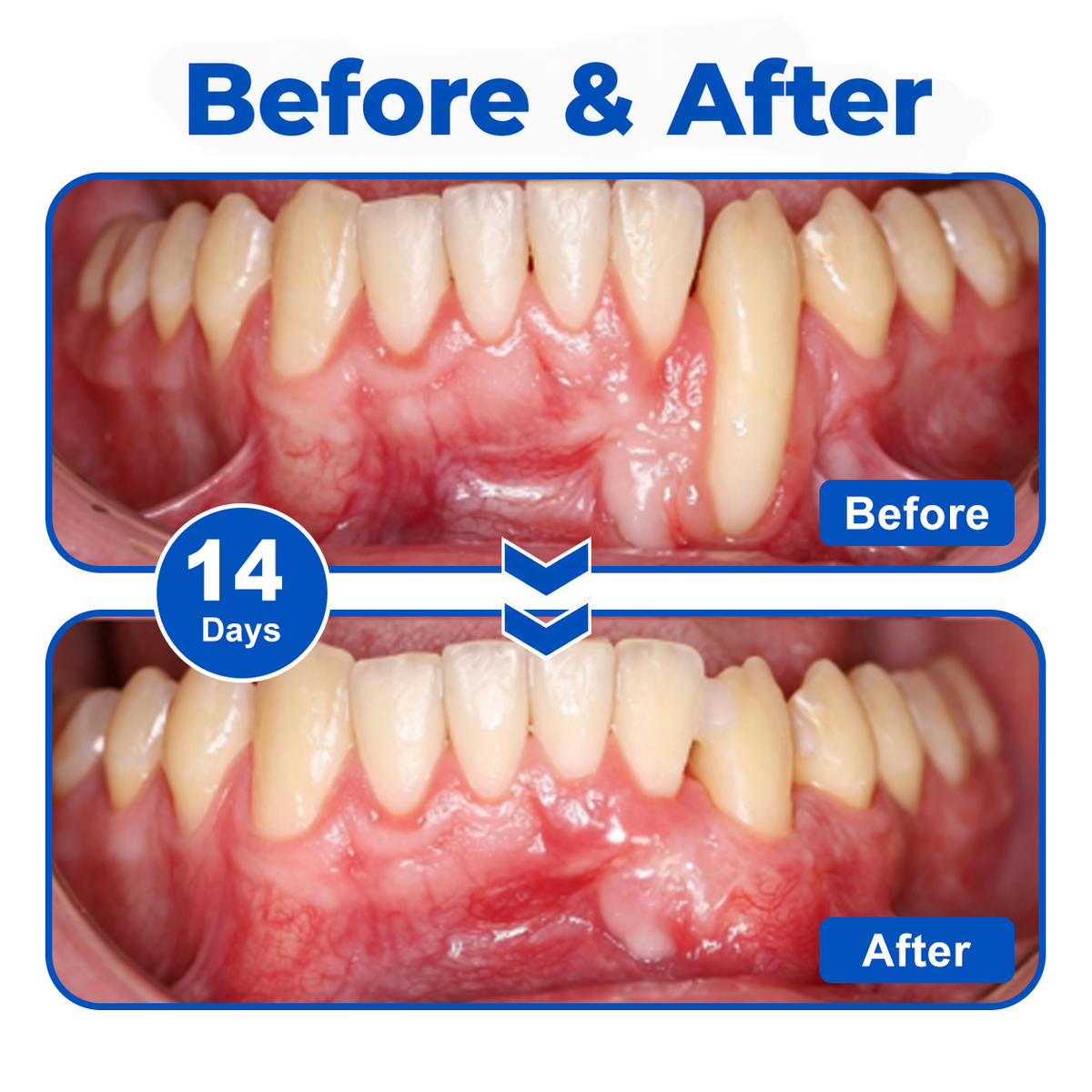 🇬🇧🏅🦷🛡️InnoMedix® GumRevive Periodontal Repair Gel💎💎