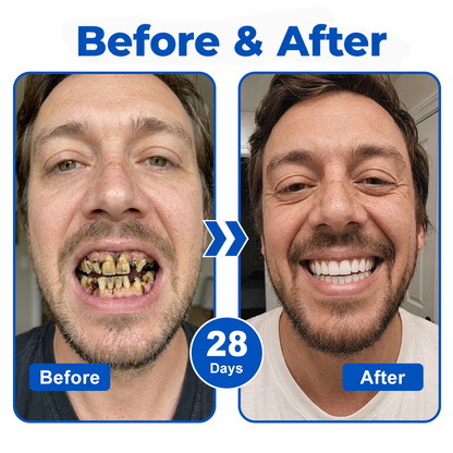 🇬🇧🏅🦷🛡️InnoMedix® GumRevive Periodontal Repair Gel💎💎