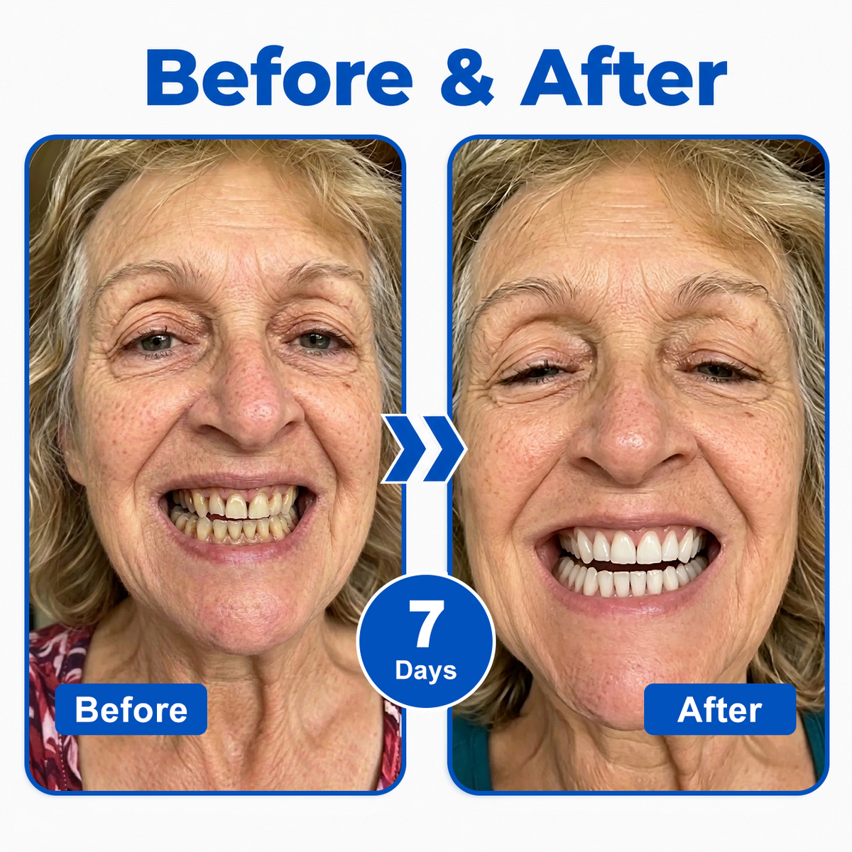 🇬🇧🏅🦷🛡️InnoMedix® GumRevive Periodontal Repair Gel💎💎