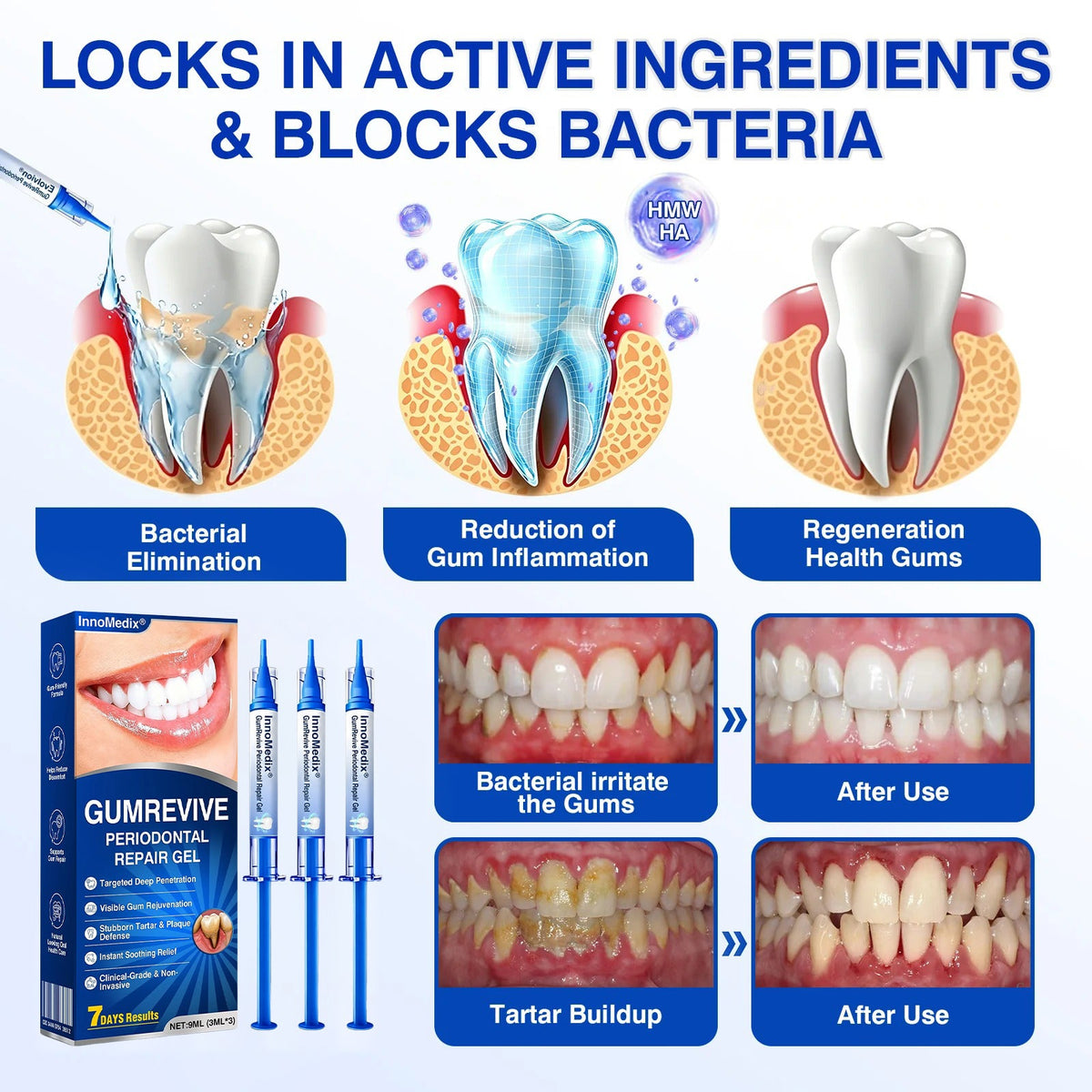 🇬🇧🏅🦷🛡️InnoMedix® GumRevive Periodontal Repair Gel💎💎