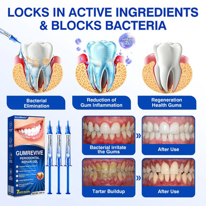 🇬🇧🏅🦷🛡️InnoMedix® GumRevive Periodontal Repair Gel💎💎