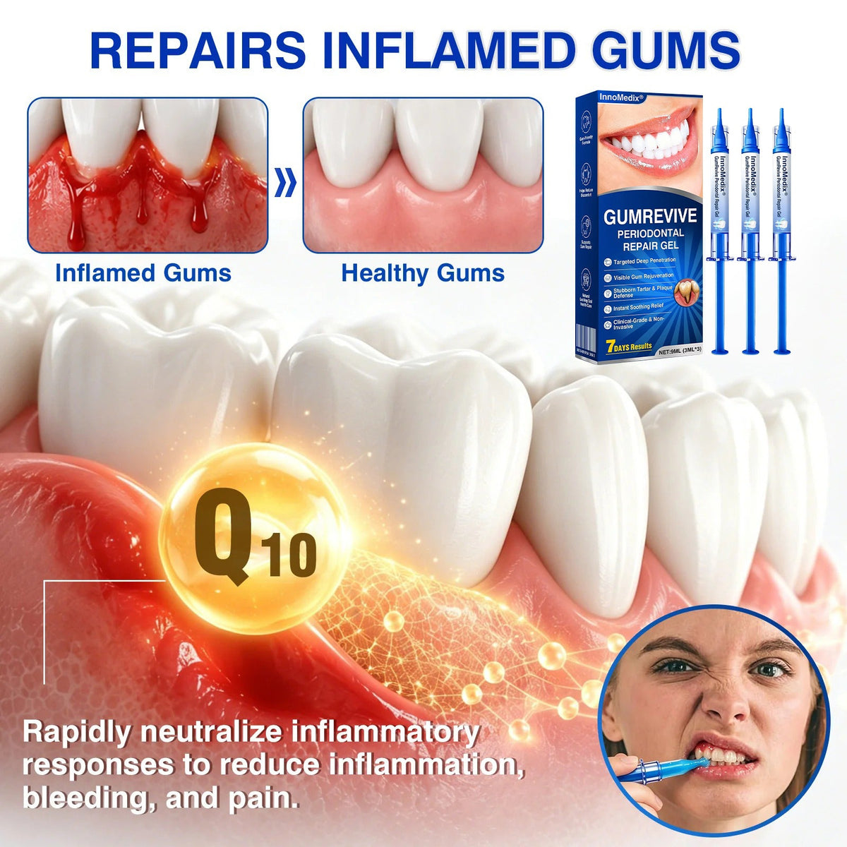 🇬🇧🏅🦷🛡️InnoMedix® GumRevive Periodontal Repair Gel💎💎